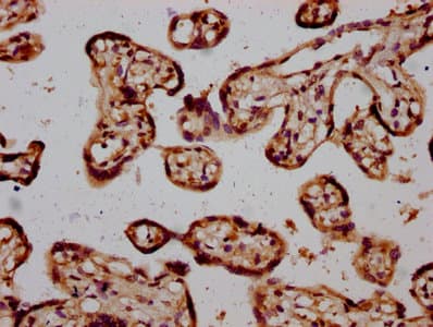 STH Antibody