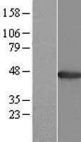 Human AGXT / SPT Protein (Over-Expression Lysate Myc-DDK (Flag))