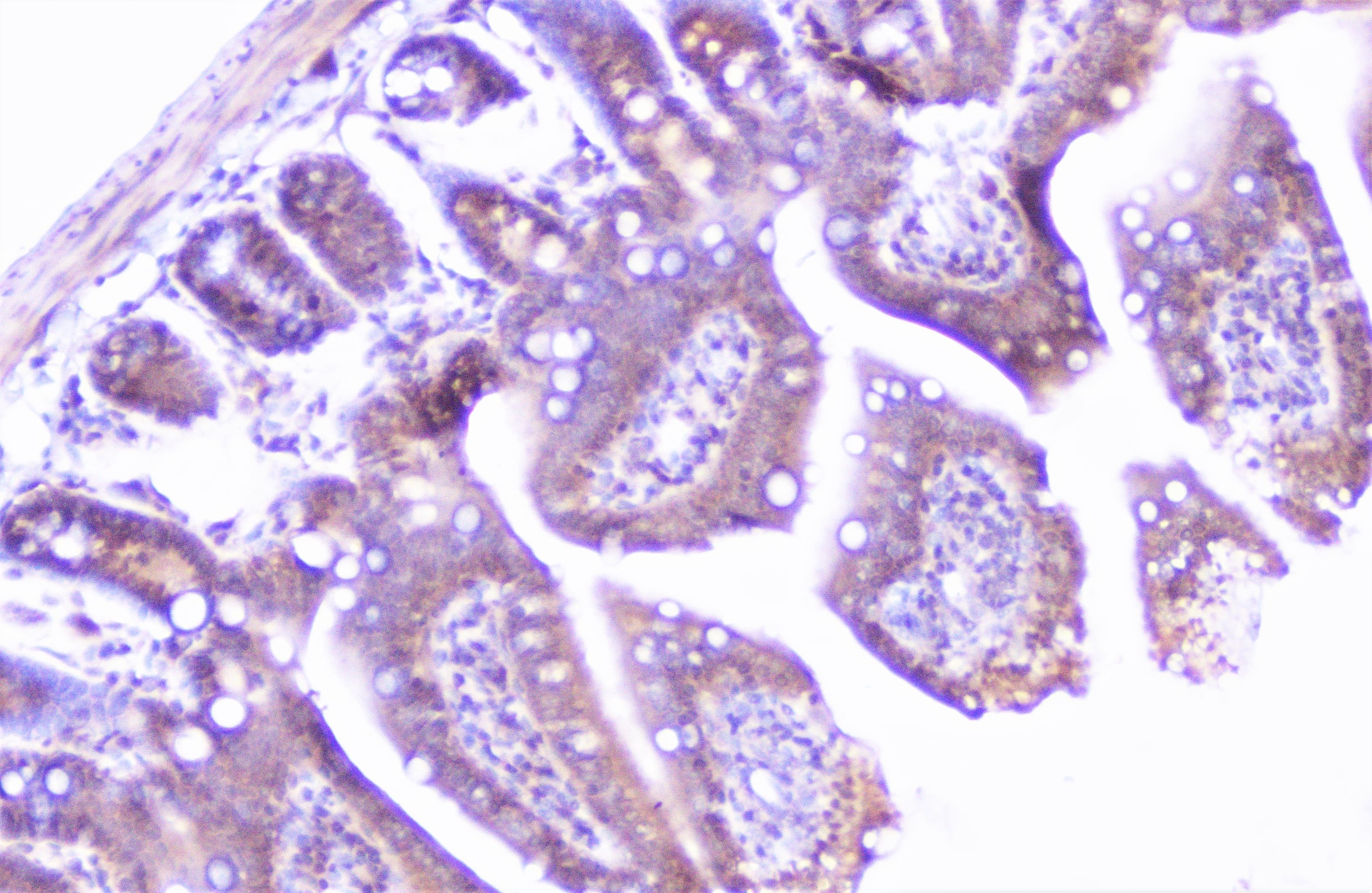 CTTN / Cortactin Antibody