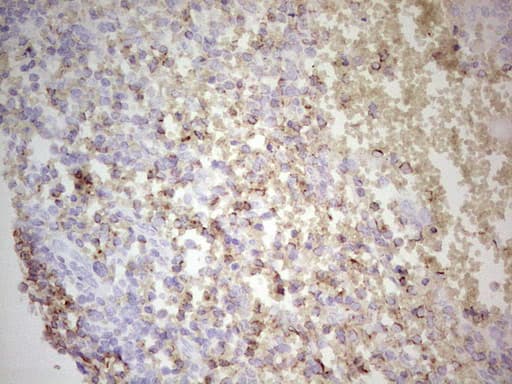 Monoclonal Mouse anti-Human BCL2 / Bcl-2 Antibody (clone OTI7H9, IHC, WB)
