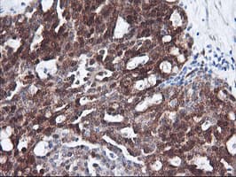 FBXO21 Antibody (clone OTI1E1)