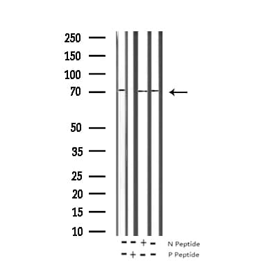 RPS6KB1 / P70S6K / S6K Antibody (phospho-Ser411)