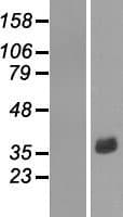 NR1I3 / CAR Protein (Over-Expression Lysate Myc-DDK (Flag))