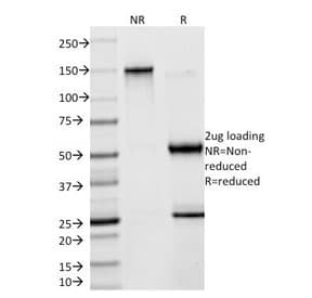 Monoclonal Mouse anti-Human CKB / Creatine Kinase BB Antibody (clone 2ba6, Azide-free,BSA-free, IHC, IF)