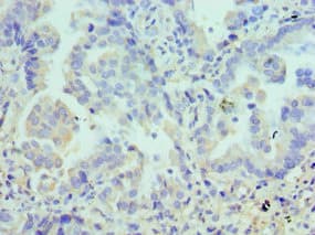 LYVE1 Antibody (aa20-238)