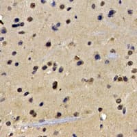 AICAR / ATIC Antibody
