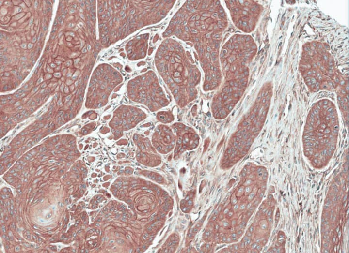 Polyclonal Rabbit anti-Human FGFRL1 Antibody (aa150-476, IHC, WB)