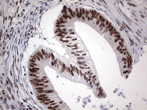 PPP1R8 / Rnase E Antibody (aa1-225, clone OTI4D5, Carrier-free)