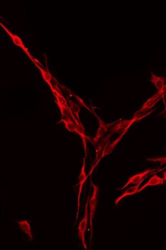 Polyclonal Rabbit anti-Human ST6GAL1 / CD75 Antibody (IHC, IF, WB)