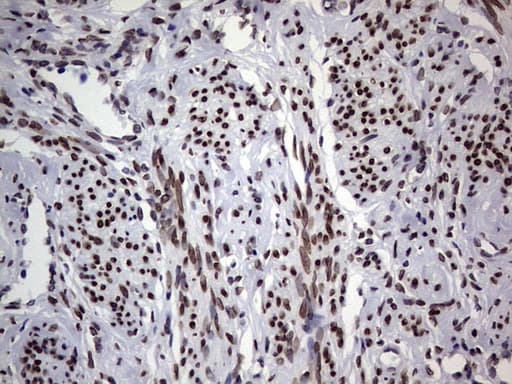 Monoclonal Mouse anti-Human TLK2 Antibody (clone OTI2G1, Carrier-free, aa1-296, IHC, WB)