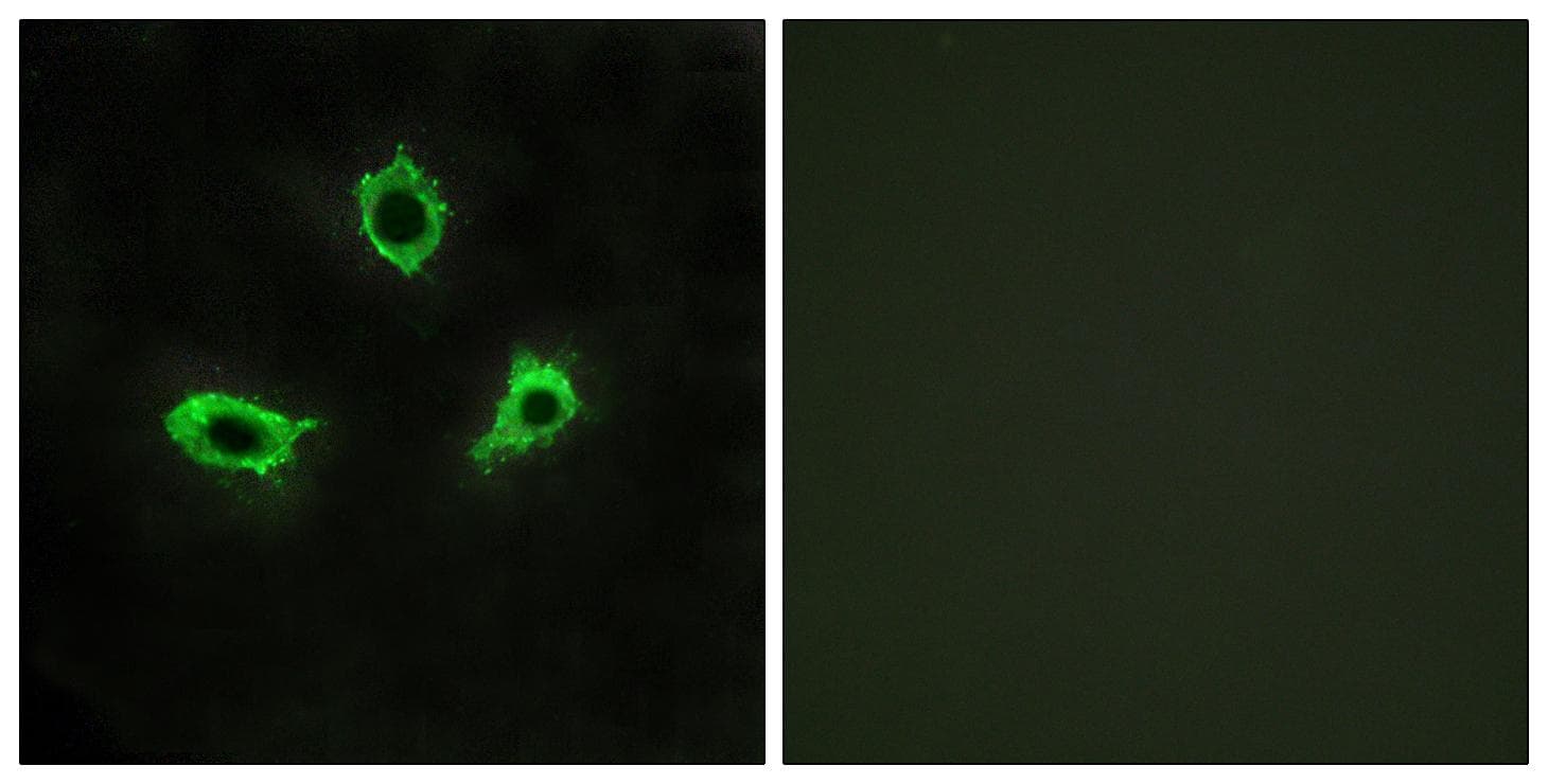 Polyclonal Rabbit anti-Human ADGRF4 / GPR115 Antibody (IF, WB)