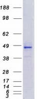 Human CYP4F12 Protein (Recombinant Myc-DDK (Flag))