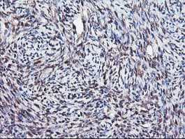 COPS5 / JAB1 Antibody (clone OTI2B12)