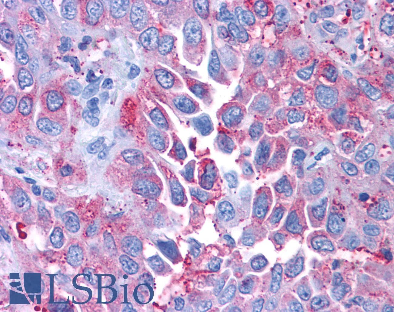 PathPlus™ Polyclonal Rabbit anti-Human CRFR1 / CRHR1 Antibody (Extracellular Domain, IHC)