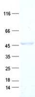 Human ACOT1 Protein (Recombinant His, N-Terminal)