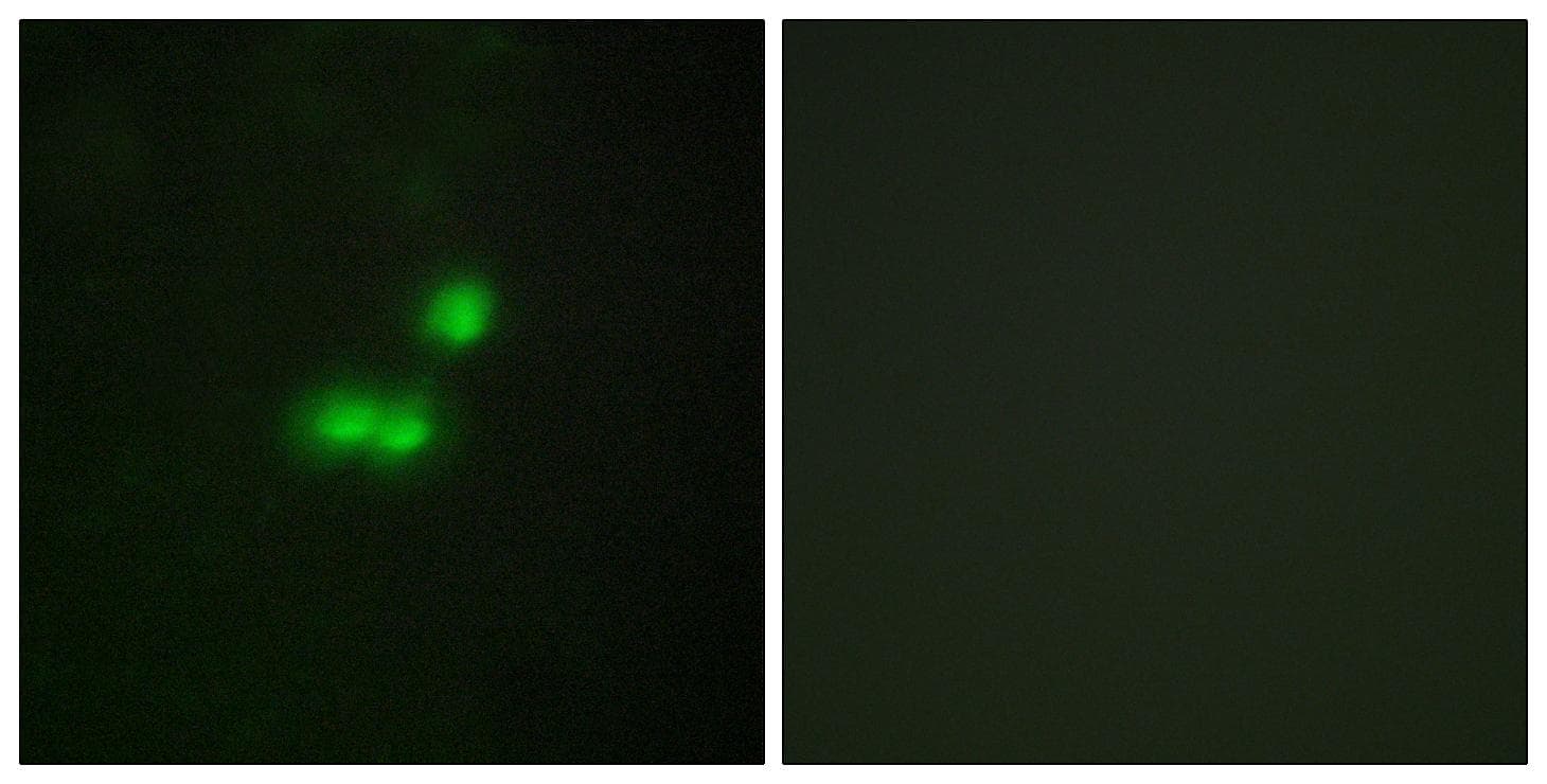 BRF1 Antibody