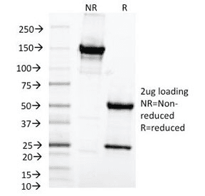 Monoclonal Mouse anti-Human MAML2 Antibody (clone MAML2/1302, Azide-free,BSA-free, IHC, IF, WB)