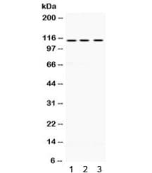 UNC5H3 / UNC5C Antibody