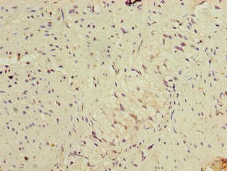 FBXW10 Antibody