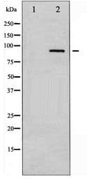 Polyclonal Rabbit anti-Human PRKCA / PKC-Alpha Antibody (IHC, WB)
