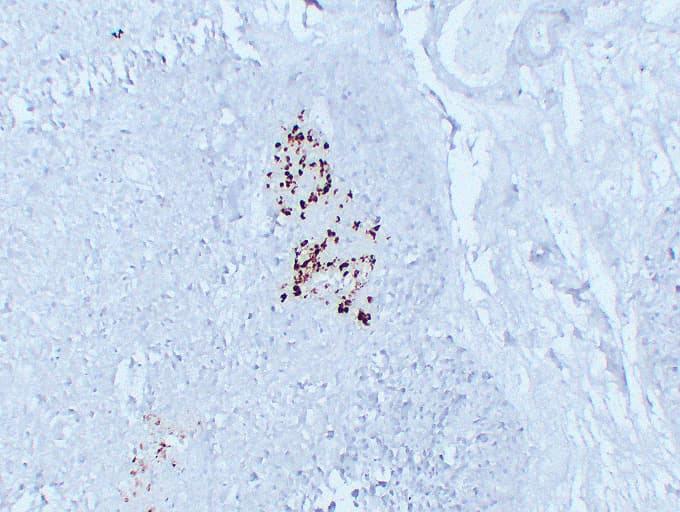 GCG / Glucagon Antibody (clone ABT-GCG)