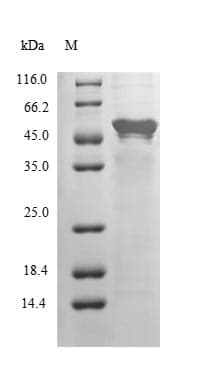 Human COPS2 / TRIP15 / ALIEN Protein (Recombinant)