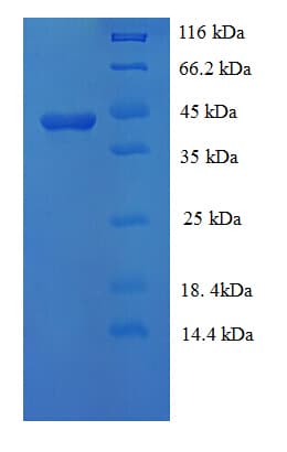 Mycoplasma hyopneumoniae 46 kDa surface antigen Protein (Recombinant His)