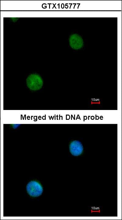 MYBPC2 Antibody (aa411-729)