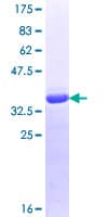Human RENT1 / UPF1 Protein (Recombinant GST, N-terminus)
