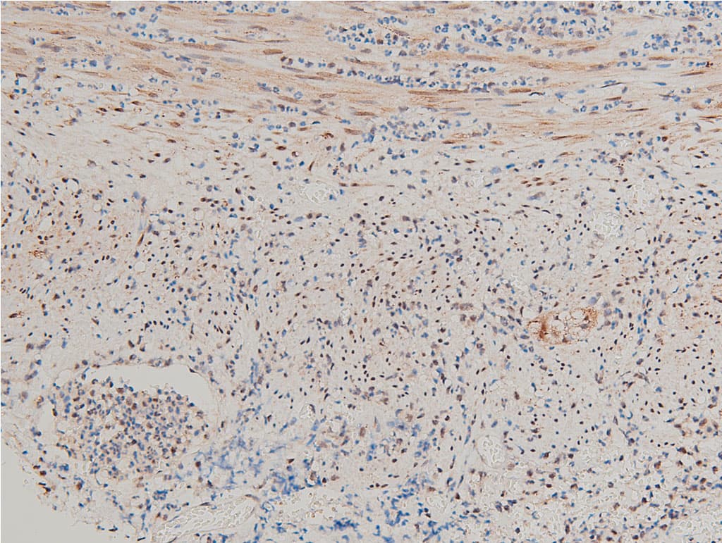 LIMK1 / LIMK Antibody (phospho-Thr508)
