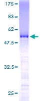 Human SMNDC1 Protein (Recombinant GST)