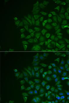 LRAT Antibody