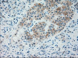 TRPM4 Antibody (clone OTI14F1, Carrier-free)