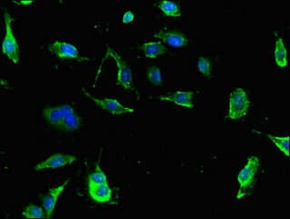 TPH1 / Tryptophan Hydroxylase Antibody