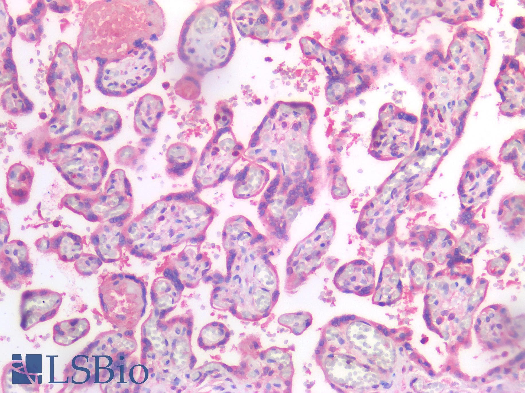 IHC-plus™ Polyclonal Rabbit anti-Human MMP2 Antibody (IHC)