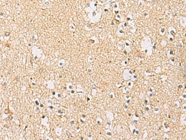 IDS / Iduronate 2 Sulfatase Antibody