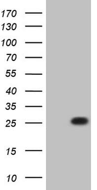ANGPTL8 / Betatrophin Antibody (aa22-198, clone OTI5A2, Carrier-free)