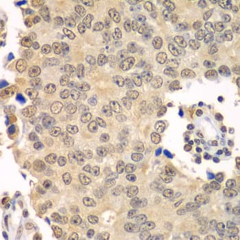 Polyclonal Rabbit anti-Human HDAC2 Antibody (IHC, IF, WB)