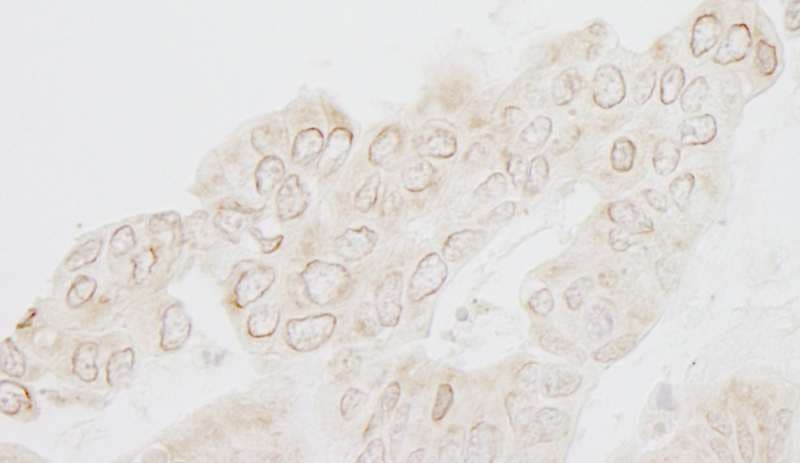 WDFY3 / ALFY Antibody (aa500-550)