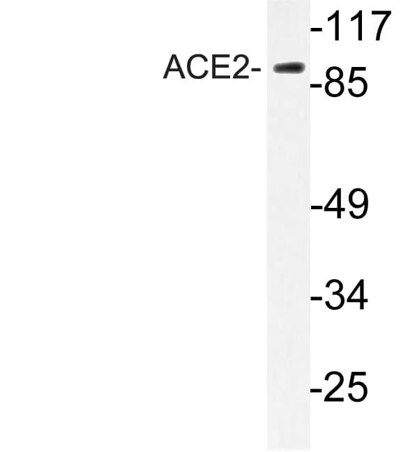 ACE2 / ACE-2 Antibody (aa416-465)