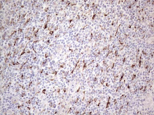 Monoclonal Mouse anti-Human CLU / Clusterin Antibody (clone OTI5D3, aa23-227, IHC, WB)