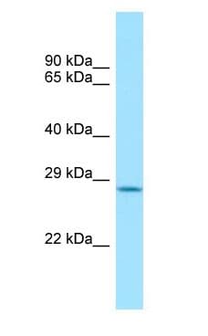 ASB1 Antibody (aa236-285)