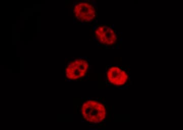 SMAD2 Antibody (phospho-Ser467)