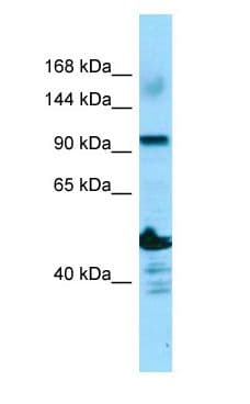 ADAMTS14 Antibody (aa209-258)