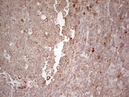 Monoclonal Mouse anti-Human LPIN3 / Lipin-3 Antibody (clone OTI1C9, IHC)