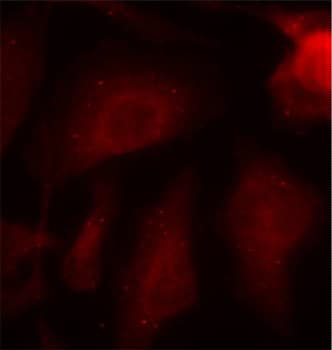 MAPT / Tau Antibody (phospho-Ser404)