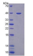 Human PON3 Protein (Recombinant His)