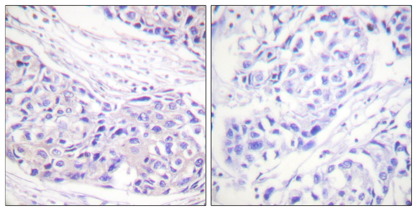 RPS6KA1 / RSK1 Antibody (aa331-380)