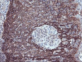 Monoclonal Mouse anti-Human FXYD3 Antibody (clone OTI1E8, IHC, IF, WB)