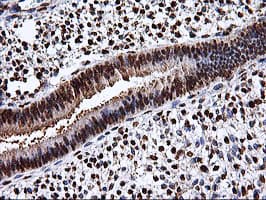 EPM2AIP1 Antibody (clone OTI1G9)